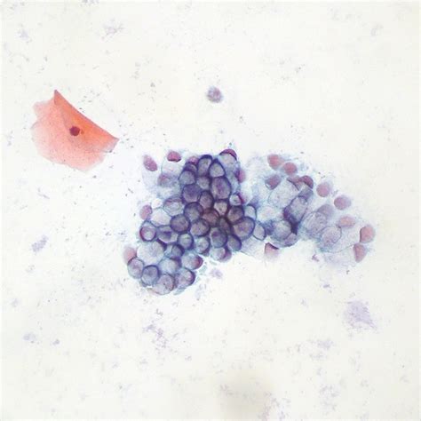 Endocervical cells (on end and on their side) | Cell, Pap smear, Window ...