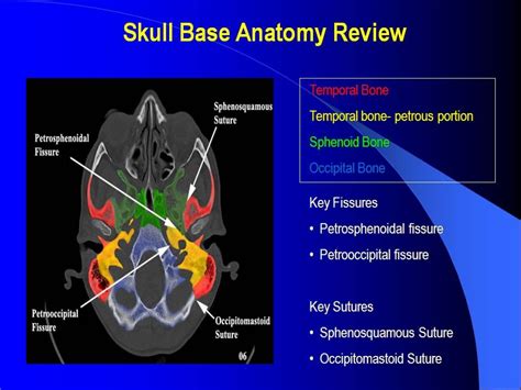 Mri Skull Base Bone Anatomy