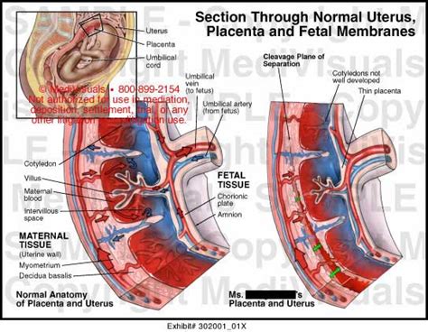 Medivisuals Section Through Normal Uterus, Placenta and Fetal Membranes ...