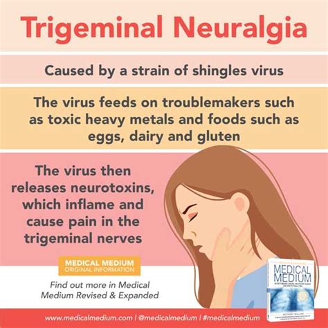 Trigeminal Neuralgia