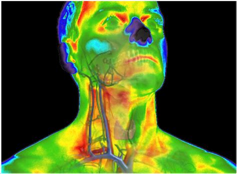 Buying an infrared medical thermography system