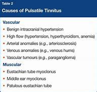 The Cause of Pulsatile Tinnitus Explained - Pulsatile Tinnitus