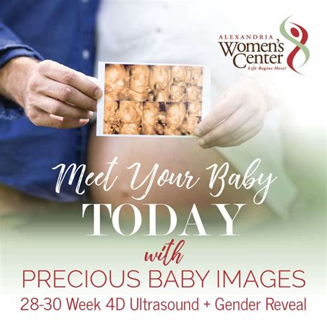 Baby Images & Ultrasounds - Alexandria Women's Center