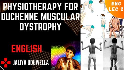 Physiotherapy for Duchenne muscular dystrophy (DMD) - Myopathy in English | Treatment ...