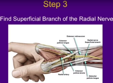 Surgery for deQuervain’s Tenosynovitis — OrthopaedicPrinciples.com