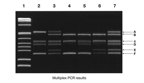 The Electrophoresis Results Best Support Which of the Following