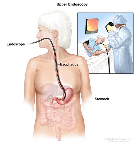 Gastric Cancer | Vanderbilt-Ingram Cancer Center