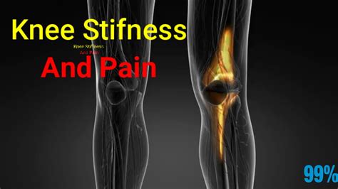 Knee stiffness and Pain: Causes And Treatment. - YouTube