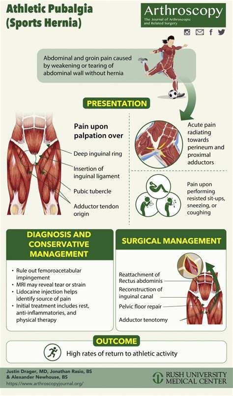 Athletic Pubalgia (Sports Hernia): Presentation and Treatment - Arthroscopy