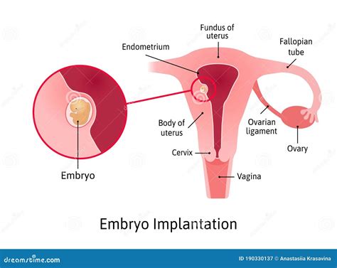 Implantation. Stage of Pregnancy when Embryo Adheres To the Wall of the ...