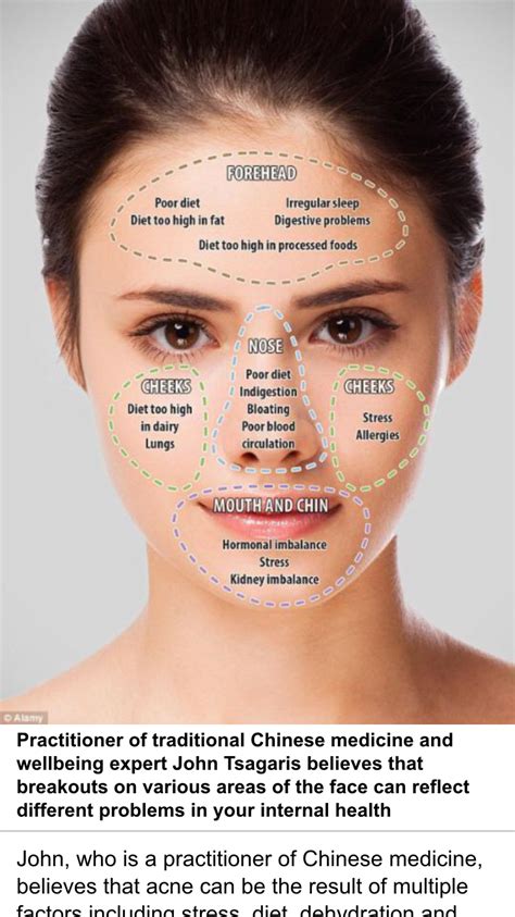 Pin by Kellee Rosales on health & fitness foods | Face mapping acne, Face acne, Natural skin care