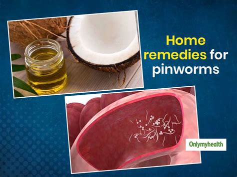 Use These 5 Natural Home Remedies To Get Rid Of Pinworms | OnlyMyHealth