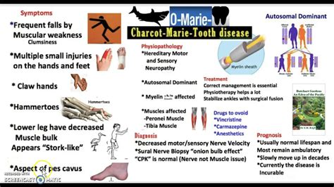 Charcot Marie Tooth Disease Usmle - Quotes Viral