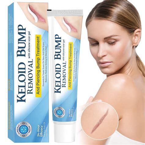 Buy Senhorita Keloid Bump Removal, Keloid for Nose & Ear & Belly ...