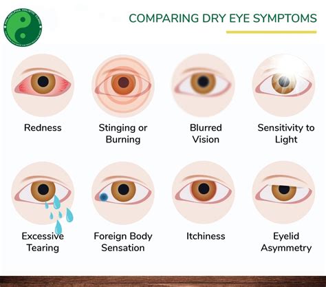 Treatment for Dry Eyes - Philadelphia Holistic Clinic - Dr. Tsan & Assoc.