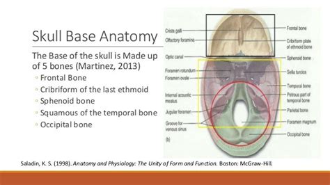 Basal skull fractures