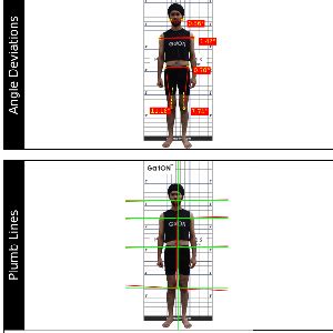 Posture Analysis System_ Plumb Lines & Postural Deviations - auptimo