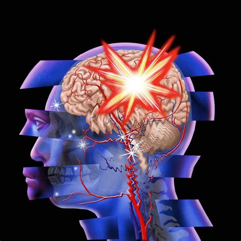 Traumatic Brain Injury & Drugs | Victory Addiction Recovery Center