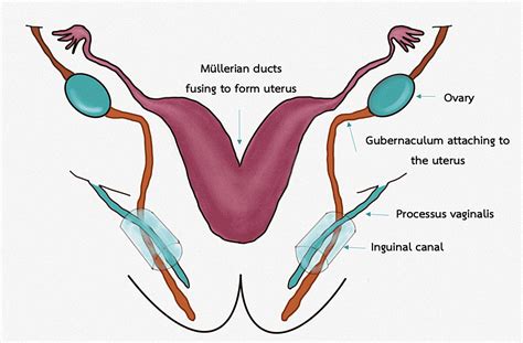 Cureus | Hydrocele of the Canal of Nuck: A Review