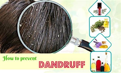 40 Tips How to Prevent Dandruff in Adults & Babies Fast & Naturally at Home