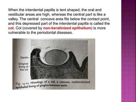 Histology of Gingiva