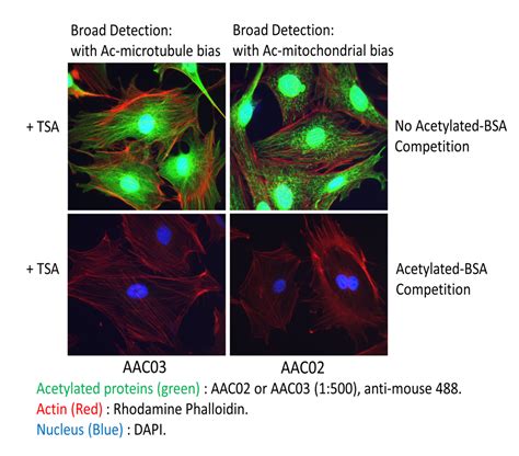 Tracking changes in mitochondrial acetylation by immunofluorescence ...