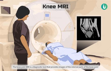 Knee MRI: Procedure, Purpose, Results, Normal Range, Cost, Price, Online Booking