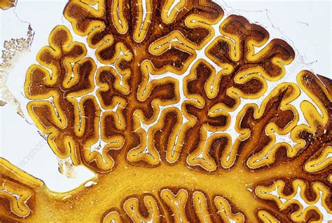 Brain tissue - Stock Image - P330/0377 - Science Photo Library