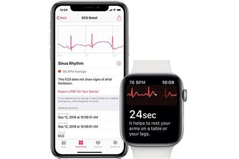 Apple Watch, With Some Maneuvering, Can Deliver 12-Lead ECG | MedPage Today