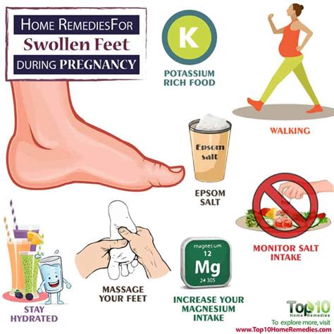 Home Remedies for Swollen Feet during Pregnancy | Top 10 Home Remedies