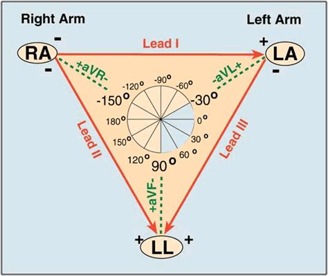 ECG Learning Center - An introduction to clinical electrocardiography