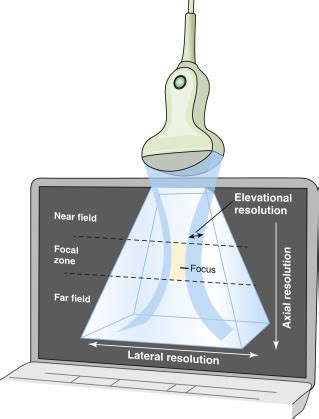 Ultrasound Physics | Radiology Key