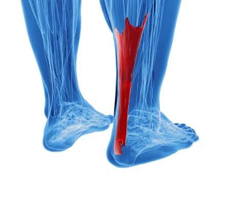 Research Points The Way Down Tendinosis Treatment Path - Physical ...