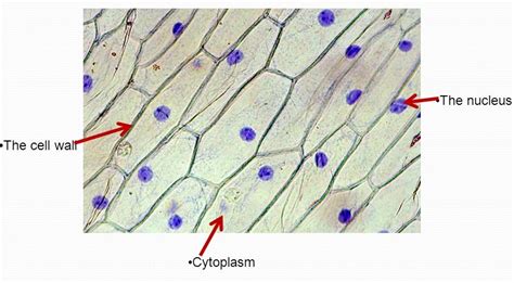 Onion Skin Cell Labeled