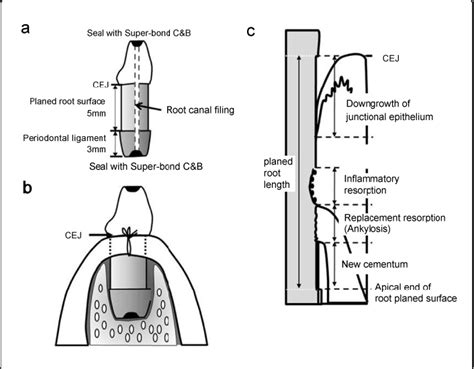 Figure 1 from The Effect of EMD Application for Intentional Replantation of Periodontally ...