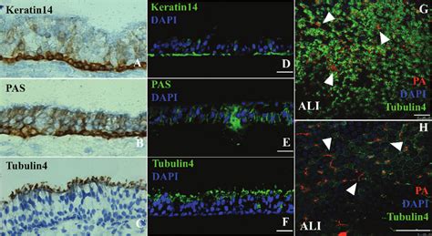 The differentiation of epithelial cells was ascertained by HE stain and... | Download Scientific ...