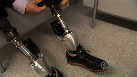 Bionic men: Amputees say next-generation prosthetics respond like the ...