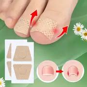 Toenail Straightening Patches Uncharged Flexible Material - Temu