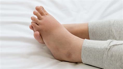 6 Exercises That Can Help You Lose Cankles | 6 Minute Read