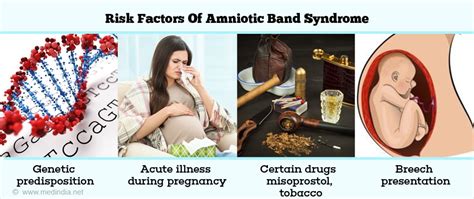 Amniotic Band Syndrome - Causes, Risk Factors, Symptoms, Diagnosis & Treatment