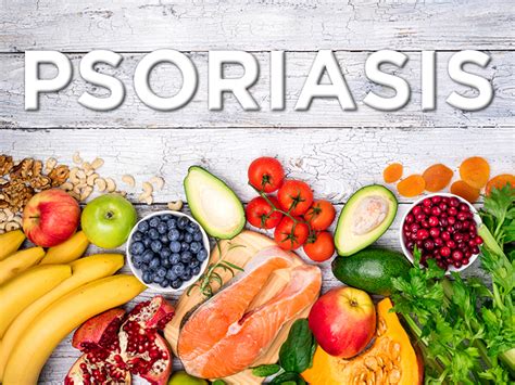 Can Diet Help in Psoriasis? | MedPage Today