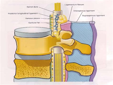 HEALTH FROM TRUSTED SOURCES: Epidural steroid injections for spinal pain