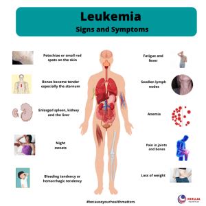 Leukemia: Signs and Symptoms