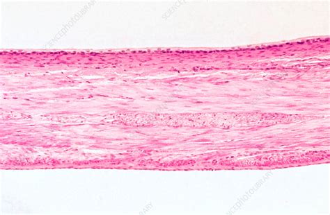 Urinary bladder epithelium, LM - Stock Image - C043/4735 - Science Photo Library