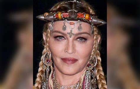 Madonna's Shocking Plastic Surgery Makeover Exposed By Top Docs