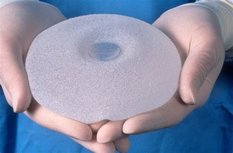 Reports of Breast Implant Illnesses Prompt Federal Review - The New ...