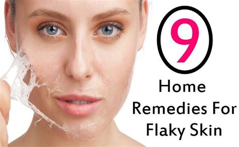 9 Home Remedies To Get Rid Of Flaky Skin | GilsCosmo.com - Shopping made easy! | Flaky skin ...