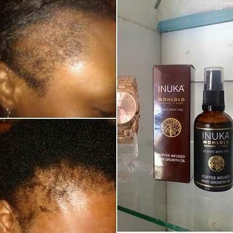 INUKA products Hair growth oil... - Rose of Sharon Zambia