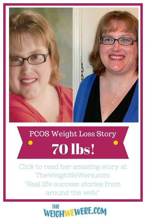 Metformin Weight Loss Pcos Success Stories - WeightLossLook