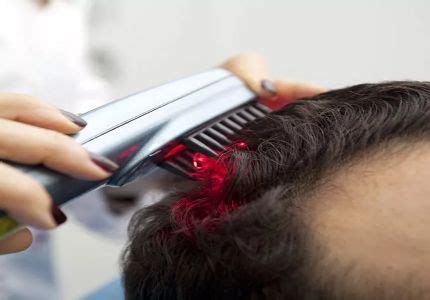 Laser Hair Therapy for Hair Loss | Tampa Bay Hair Restoration